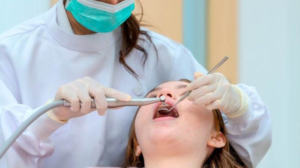Dental Implants